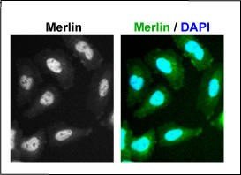 Immunofluorescent staining shows Merlin/NF2 in the nucleus of normal Schwann cells. In response to contact inhibition or loss of matrix adhesion, Merlin is dephosphorylated and inhibits the pro-mitogenic E3 ligase CRL4-DCAF1 in the nucleus. See Li et al. Cell 140:447-90, 2010.