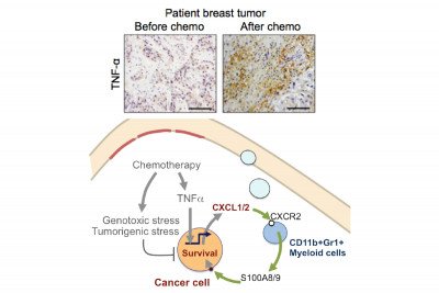 Linking metastasis and chemotherapy resistance.