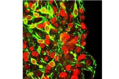 Confocal picture of dopaminergic neurons
