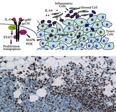 IL-6/Stat3 Signaling in Mammary Tumorigenesis