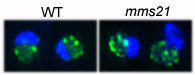 mms21 mutations lead to the disruption of telomeric (green) and nucleolar (blue) structures