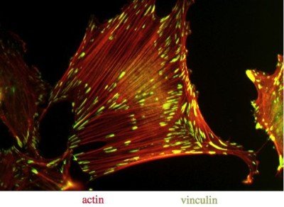 Actin & Vinculin