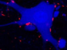 Sensory Afferent Terminals on a Spinal Motor Neuron