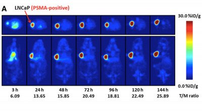 <sup>89</sup>Zr-J591 PET imaging of PSMA-positive LNCaP (A)