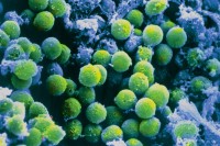 Pictured: T cells on surface on thymus 
