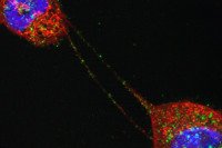 Pictured: Tunneling Nanotubes