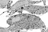 Pictured: Melanocytes 