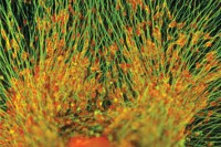 Pictured: Sensory Neurons