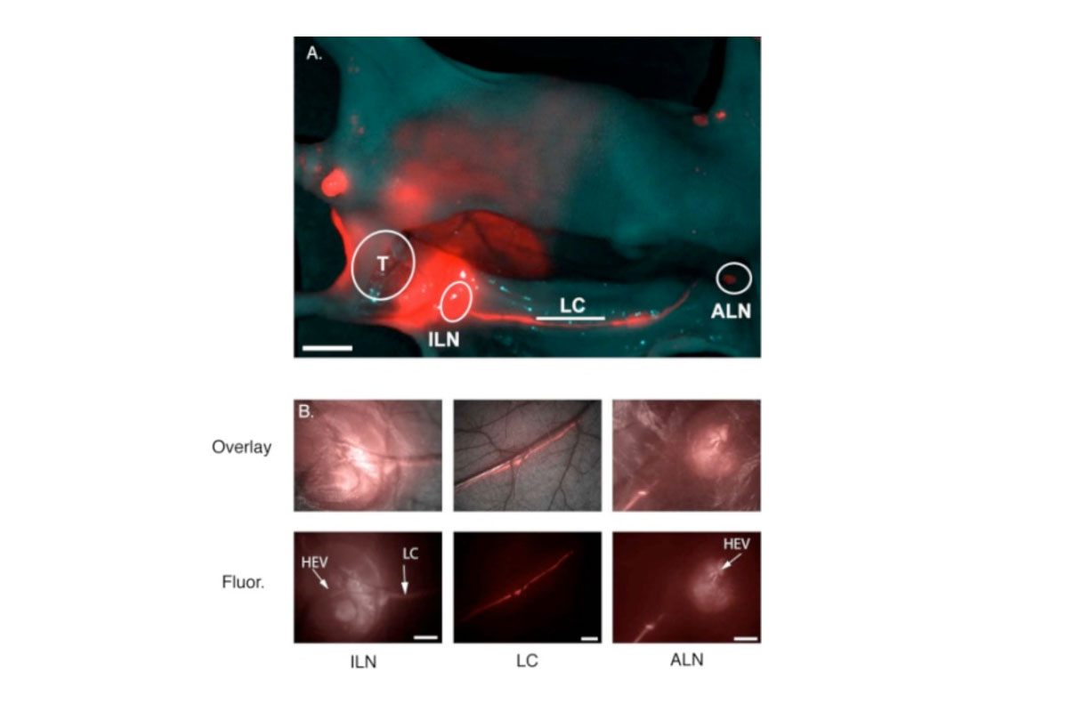 Nodal mapping using multiscale NIR fluorescence imaging