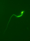 Fluorescent mouse sperm, after staining with a fluorescein-ß-galactoside conjugate.