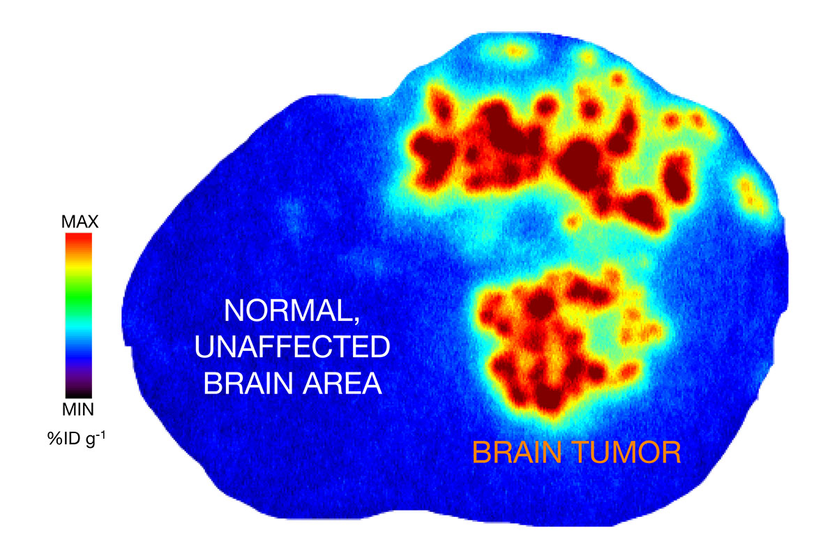 A brain scan shows PU-AD localized to a tumor in a mouse model
