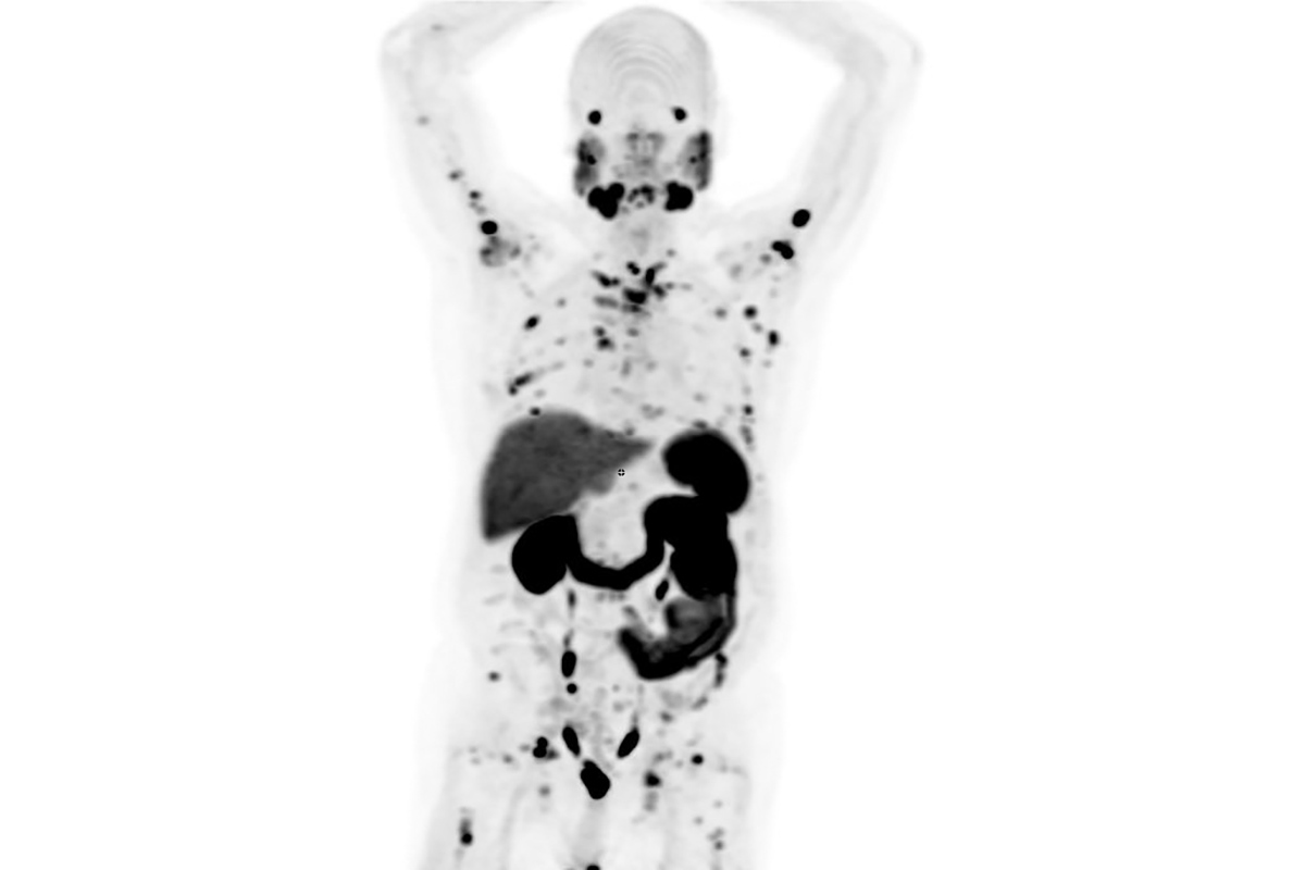 A black and white scan of a human body
