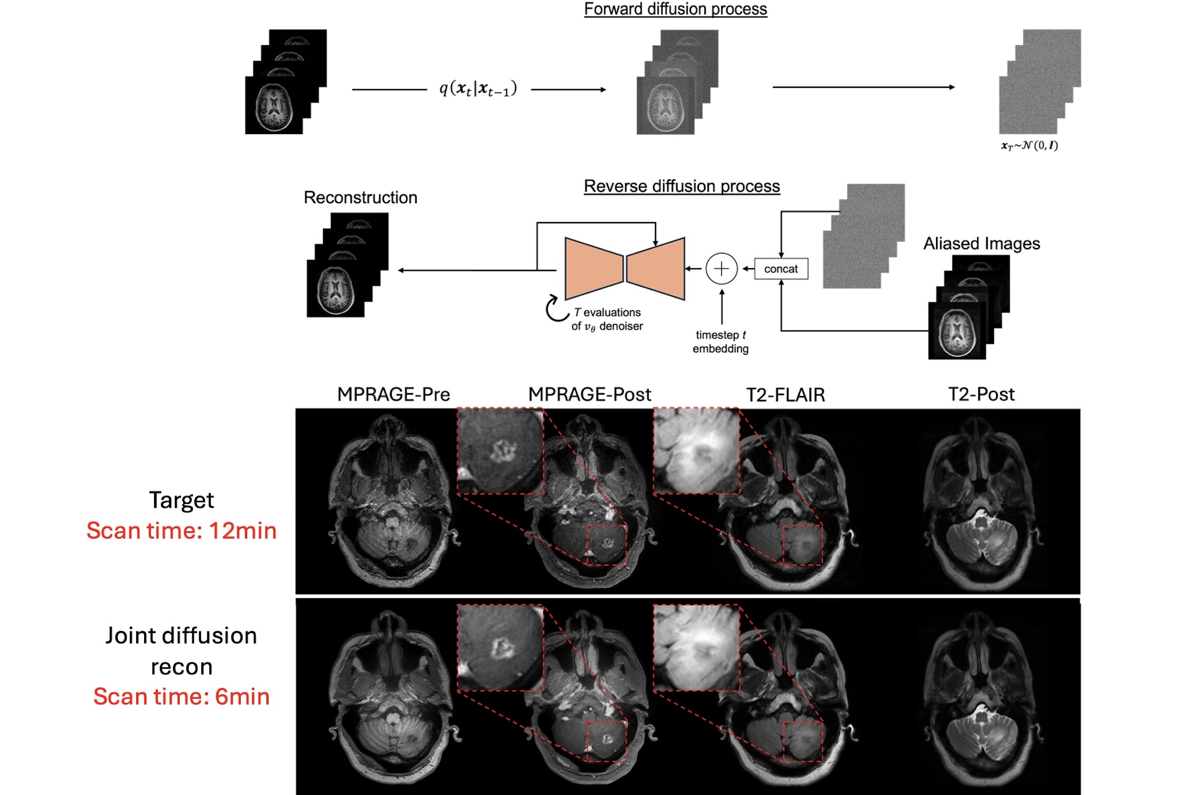 Figure 3: Generative diffusion reconstruction network to jointly accelerate 4 sequences in brain MRI with comparable image quality to the clinical standard in half the scan time.