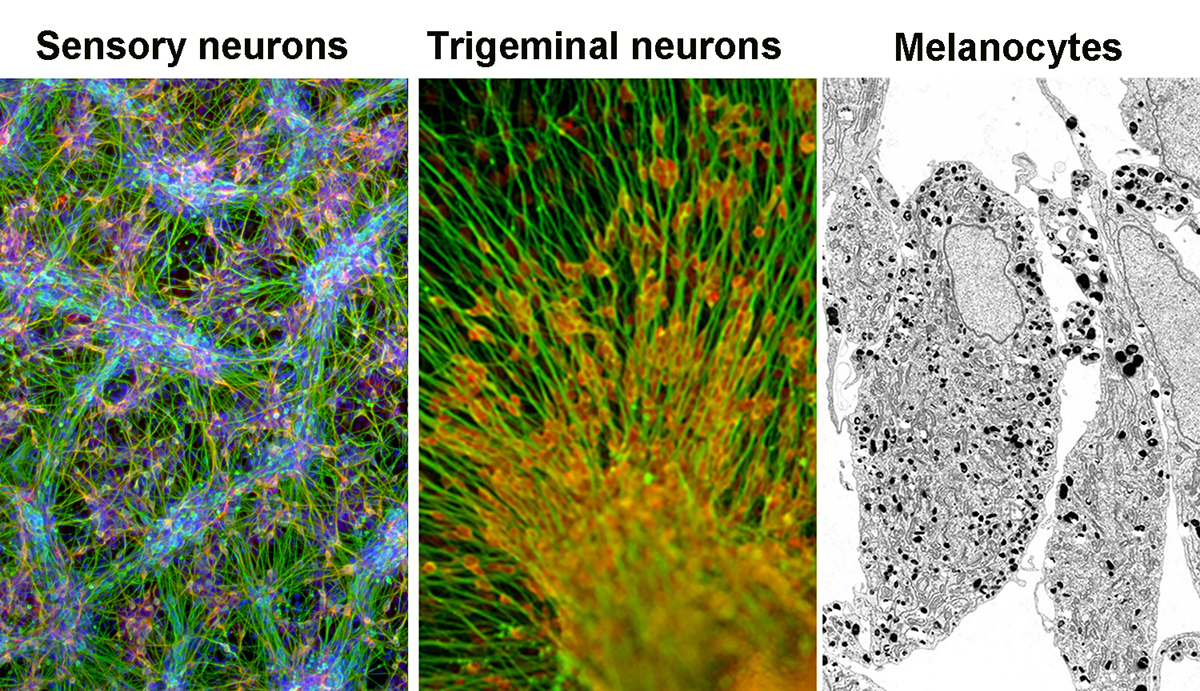 Sensory neurons of the peripheral nervous system and NC-derived melanocytes