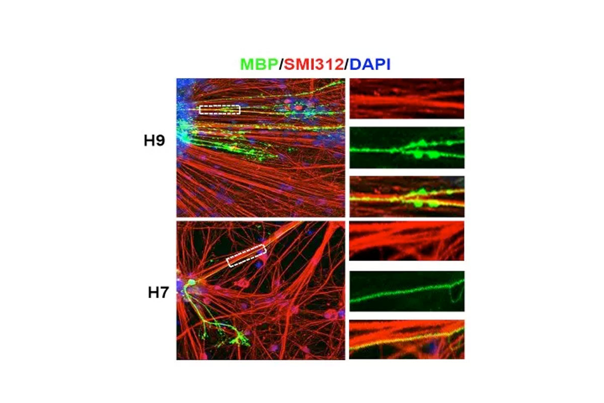 Human ES derived oligoprogenitors (green) myelinate axons in vitro 