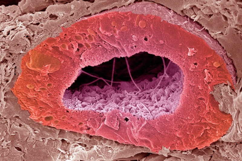 Proximal tubule of the kidney. 