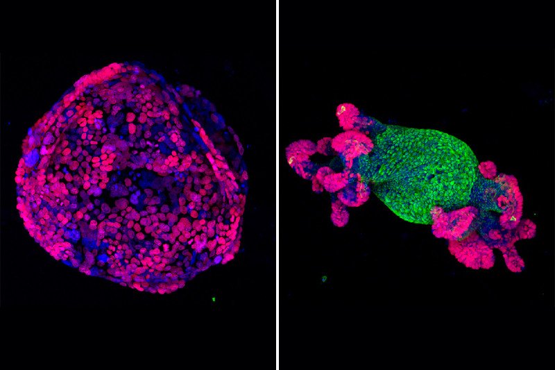 Organoid cell structures fluorescing in blue, green, and purple. 
