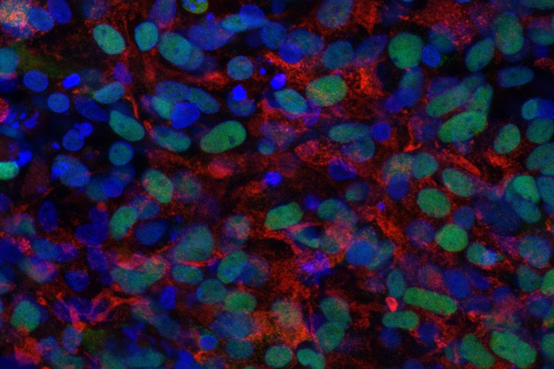 Pancreatic beta cells