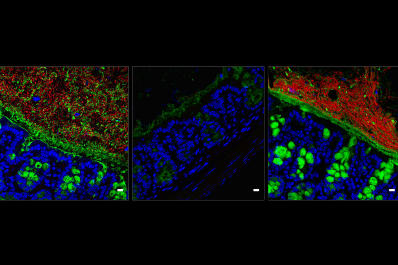 Images from three different mice showing the effects of antibiotics and microbiome replacement