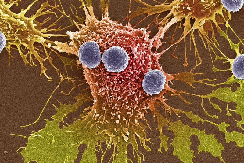 Tumor mutation model