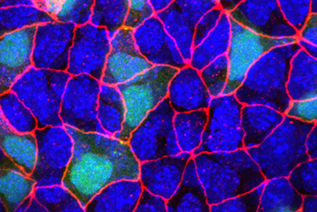 In this fluorescent microscopy image of endoderm tissue from a mouse embryo, cell membranes are red, cell nuclei are blue, and extra-embryonic endoderm cells are green (they appear turquoise because blue and green are merged).