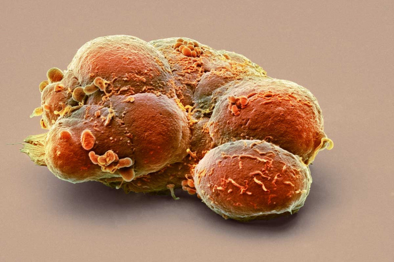  Colored scanning electron micrograph of a clump of pluripotent stem cells.