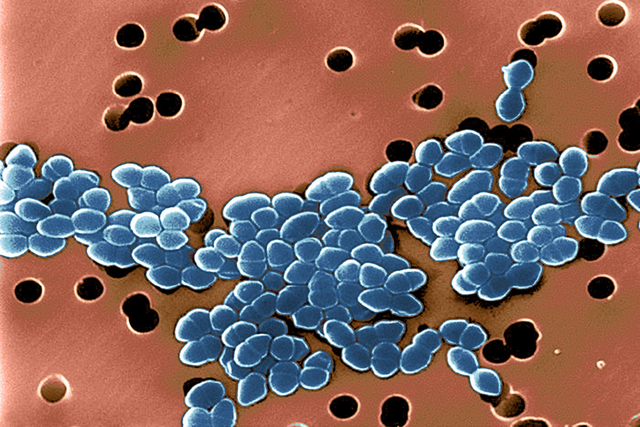 Microscopy image of vancomycin-resistant Enterococcus