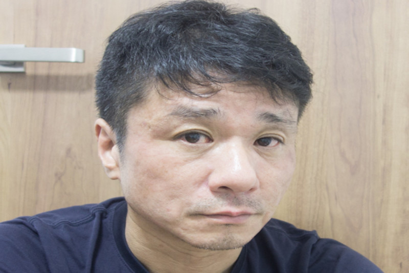 Koji Nakanishi, MD