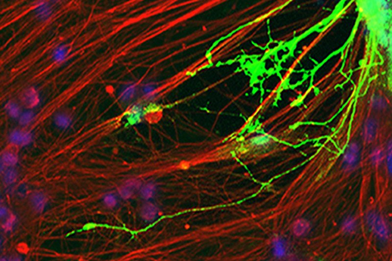 Fibrous extensions of a nerve cell (red) and an oligodendrocyte (green) growing on top of the nerve cell