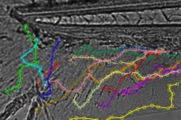 Picturing the Body’s Immune Response