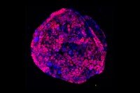 Microscopic image of spherical cluster of cells, most of them pink cells with a smaller number of blue ones.