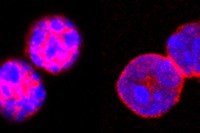 photo of Foxo1 protein stained in regulatory T cells