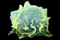 Electronic microscope enlargement of macrophage cell (tinted green)