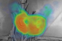 PET/CT scan of mouse prostate (displayed in green and orange).