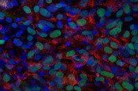 Pancreatic beta cells