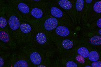 Blue cells containing small red dots on a green and black background