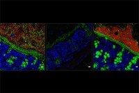 Images from three different mice showing the effects of antibiotics and microbiome replacement
