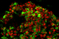Fluorescent red and green cells