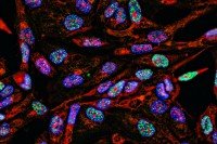 colorful picture of cancer cells