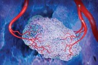 Blood vessels supply tumors with the nutrients they need to grow.