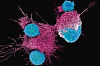 How MSK Is Improving CAR-T Cell Therapy for Cancer Treatment
