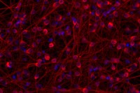 Human pluripotent stem cell-derived neurons