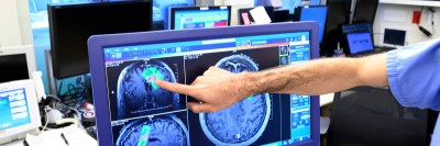 A hand points to brain images on a screen.