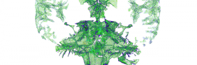 MRI of brain and spinal fluid in green