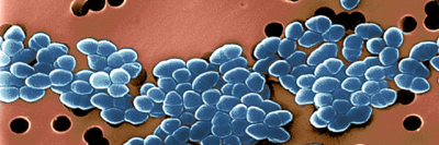 Microscopy image of vancomycin-resistant Enterococcus