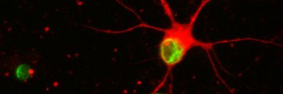Pictured: Stem cell-derived nerve cells exposed to progerin